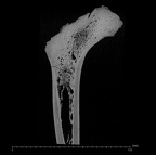 KNM-WT 15000G Homo erectus right proximal femur ct slice