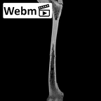 KNM-WT 15000H Homo erectus left femur ct stack movie