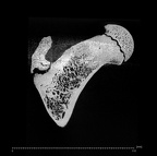 KNM-WT 15000H Homo erectus left proximal femur ct slice