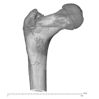 KNM-WT 15000H Homo erectus left proximal femur posterior