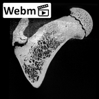 KNM-WT 15000H Homo erectus left proximal femur ct stack movie