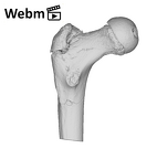 KNM-WT 15000H Homo erectus left proximal femur ply movie
