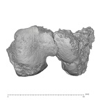 KNM-WT 15000M Homo erectus right distal femur anterior