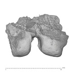 KNM-WT 15000M Homo erectus right distal femur posterior