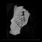 KNM-WT 15000P Homo erectus right os coxae fragment ct slice