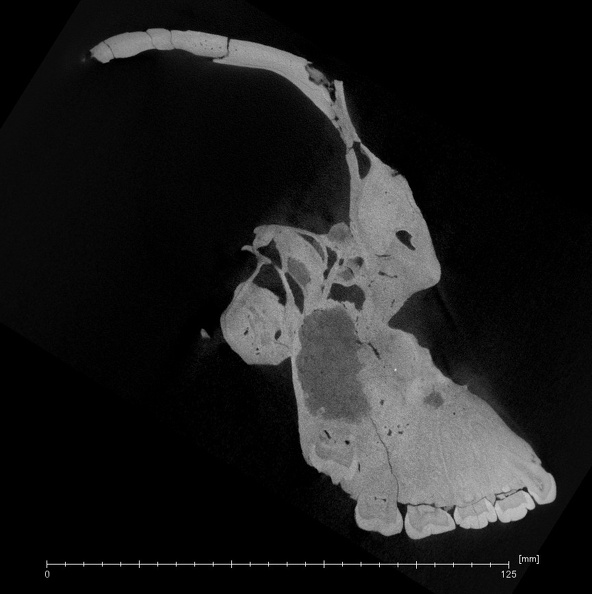 KNM-WT 17400 Paranthropus boisei cranium ct slice