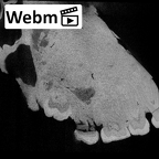 KNM-WT 17400 Paranthropus boisei maxilla ct stack movie