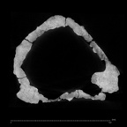 KNM-WT 40000 Kenyanthropus platyops cranium ct slice