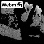 KNM-WT 8556 Hominin partial mandible ct stack movie