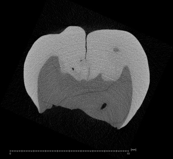 NMNH SI 18 Homo sapiens LLM ct slice