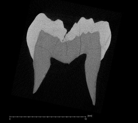 NMNH SI 43 Homo sapiens LRM ct slice