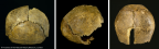 NHMUK PV M 15709 PA EM 40 Swanscombe Homo neanderthalensis cranium