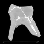 Trinil 11621 H. erectus upper molar ct slice