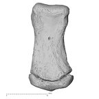 foot phalanx fifth middle right