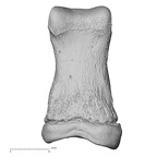 foot phalanx first proximal right
