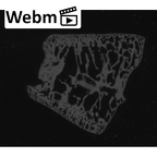 NH CAM1 107 Gorilla gorilla gorilla intermediate cuneiform right ct stack movie