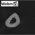 NH CAM1 107 Gorilla gorilla gorilla metatarsal fourth right ct stack movie