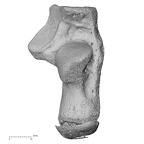 calcaneus right