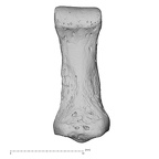 foot phalanx fifth middle right