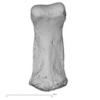 foot phalanx second middle right