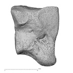 lateral cuneiform right