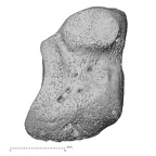medial cuneiform right