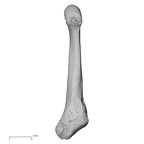 metatarsal fifth right