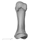 metatarsal first right