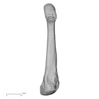 metatarsal fourth right