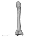 metatarsal second right