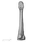 metatarsal third right