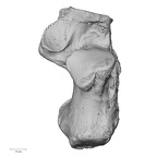calcaneus right