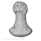 foot phalanx first distal left