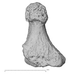 foot phalanx second distal left