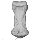 foot phalanx second middle left