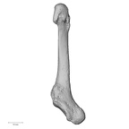 metatarsal fifth left