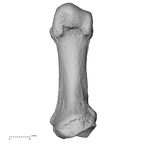 metatarsal first left