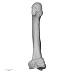 metatarsal second left