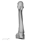 metatarsal third left