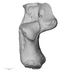 calcaneus left
