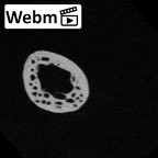 NH MER32 476 Gorilla gorilla gorilla metatarsal fifth right ct stack movie
