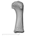 metatarsal first right