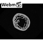 NH MER32 476 Gorilla gorilla gorilla metatarsal first right ct stack movie