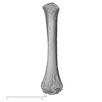 metatarsal third right