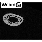 NH MER32 476 Gorilla gorilla gorilla metatarsal third right ct stack movie