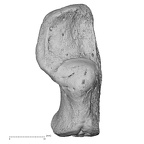 calcaneus right