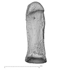 foot phalanx fifth proximal right