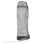 foot phalanx fourth proximal right