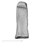 foot phalanx second proximal right