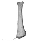 metatarsal fifth right